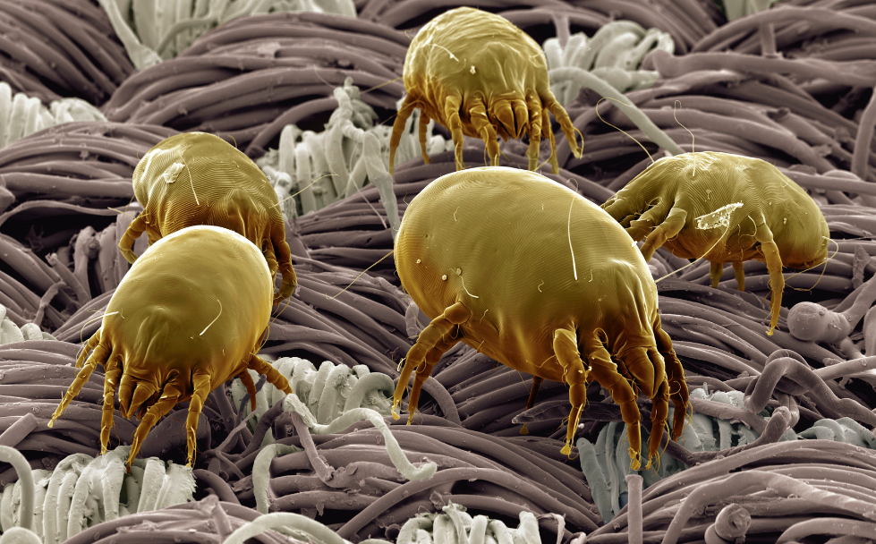 Does UV Light Kill Dust Mites?